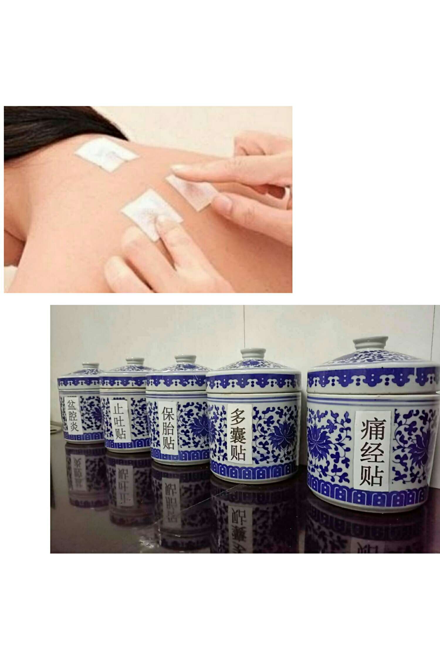 1、三伏貼能治什么?。? style=