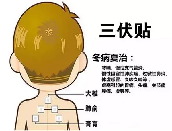 2、三伏貼的功能和功效是什么？